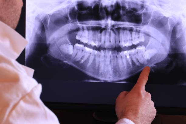 Best Emergency Tooth Extraction in Tekamah, NE