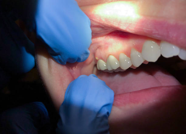 Best Cosmetic Emergency Dentistry in Tekamah, NE